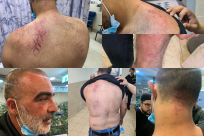 5 مصابين و3 معتقلين حصيلة اعتداء الشرطة على أهالي يافا والنائب أبو شحادة يعقّب